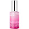 iSOi | Blemish Care Up  Serum | 35ml